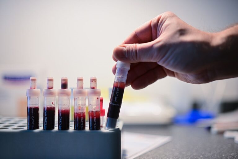 Відомо, скільки випадків ВІЛ-інфекції зафіксували в Україні з початку року