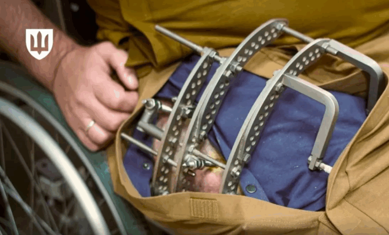 Військові почали отримувати Пакунок пораненого