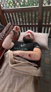 На Одещині жорстоко побили військового за зауваження про російську музику
