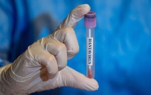 Відпочинок у Хорватії та гори: на Львівщині чоловік захворів на хантавірус